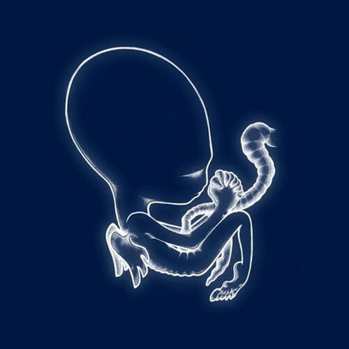 Sigur Ros - Agaetis Byrjun [Vinyl]